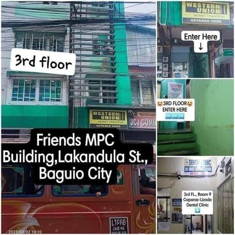 orthodontist baguio|Caparas.